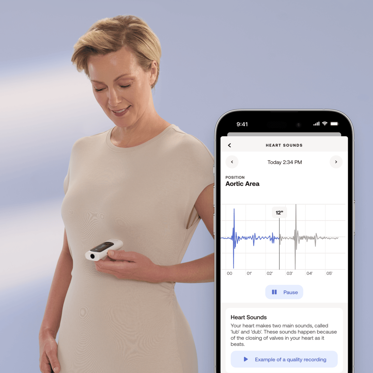 Zdravotní monitor Withings 4v1 BeamO – bílý - iSTYLE CZ