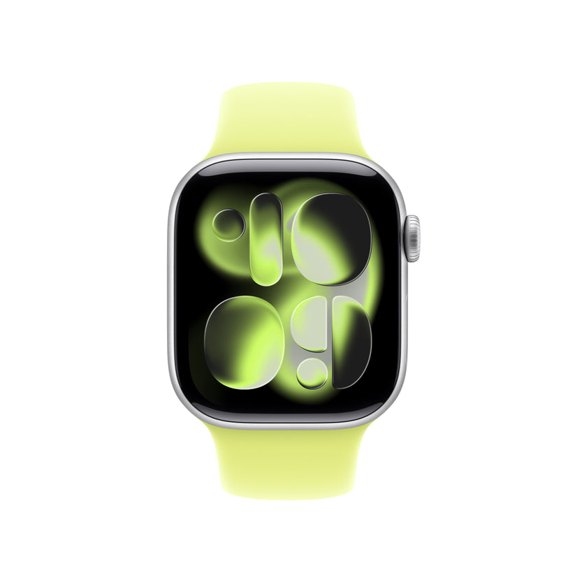 Řemínek pro Apple Watch 38/40/41/42 mm Apple neonově žlutý sportovní - S/M - iSTYLE CZ